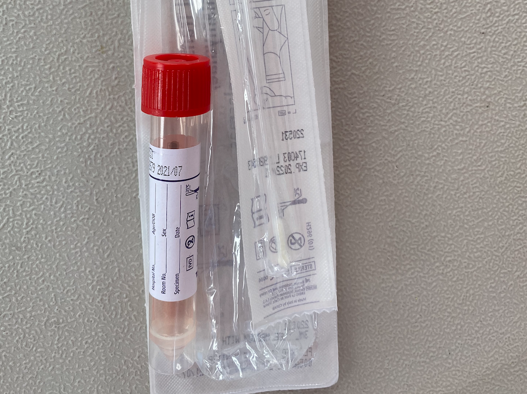TEST TUBE